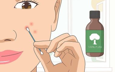 Масло чайного дерева от прыщей: применение и эффективность